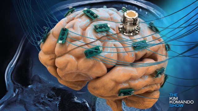 brain model over an MRI scan with neural implants